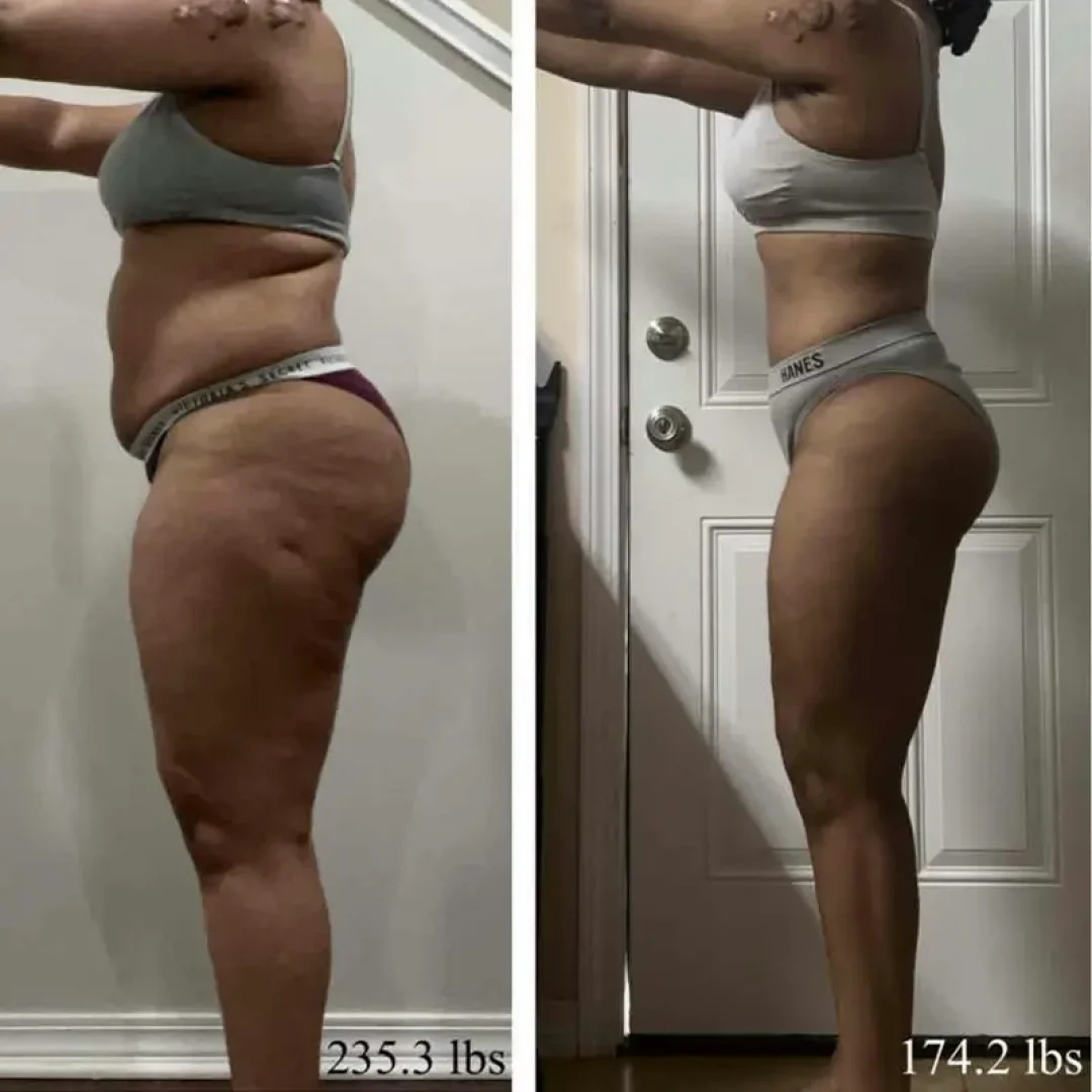 Before and after image of a young woman after undergoing a fitness plan